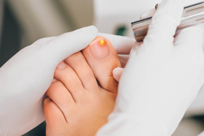 How to cure a fungal nail in my hand - Quora